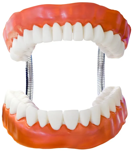 Recorte del modelo de prótesis dentales — Foto de Stock