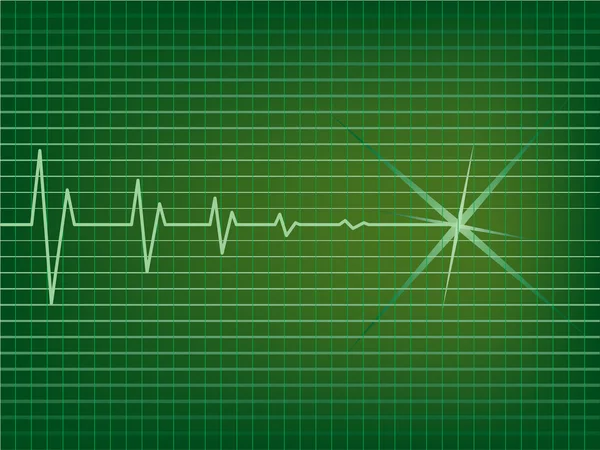 EKG — Image vectorielle