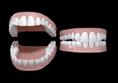 Teeth And Gums Open and Closed clipart