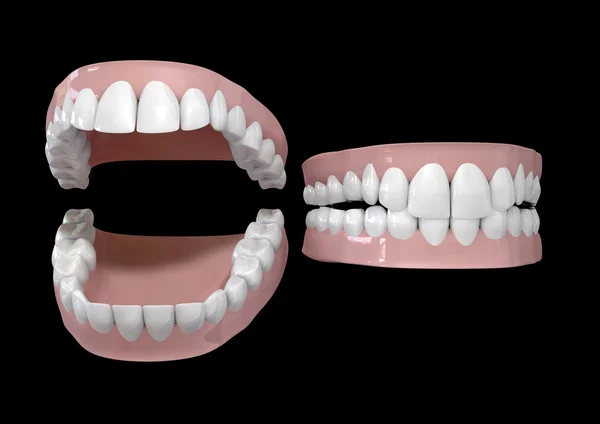 Zuby a dásně otevřené a uzavřené — Stock fotografie