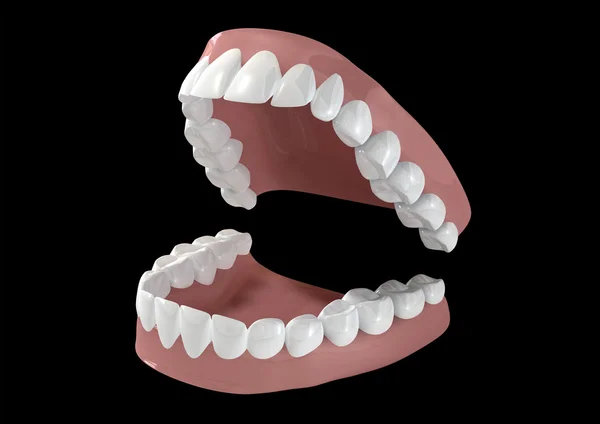 Zuby a dásně otevřené — Stock fotografie