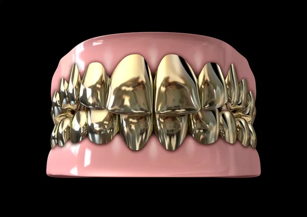 Goldene Gangsterzähne und Zahnfleisch — Stockfoto