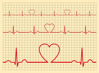 Heart monitor-Vector clipart