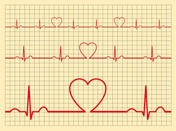 Monitor cardíaco-Vector — Archivo Imágenes Vectoriales