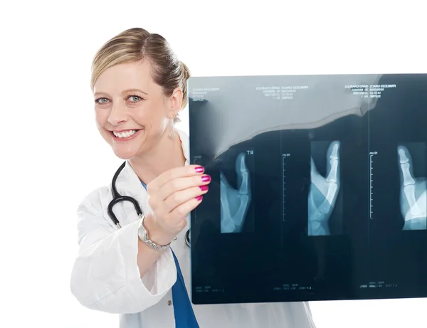 Жінка-хірург тримає рентгенівський звіт — стокове фото
