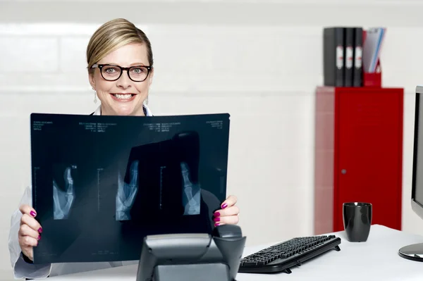 Жінка-хірург, що показує рентгенівські звіти на камеру — стокове фото