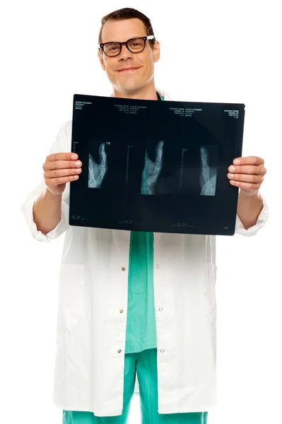 Knappe jonge chirurg bedrijf x-ray — Stockfoto