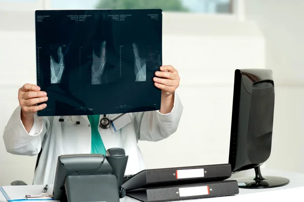 Cirujano masculino sosteniendo rayos X —  Fotos de Stock