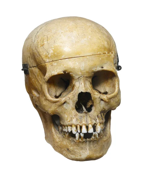 Crâne humain isolé sur fond blanc — Photo
