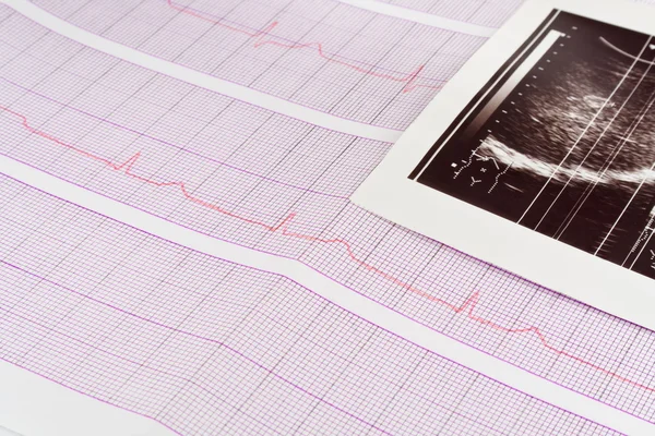 Electrocardiogram และอัลตราซาวด์ยิง — ภาพถ่ายสต็อก