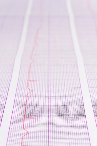 EKG közelről — Stock Fotó