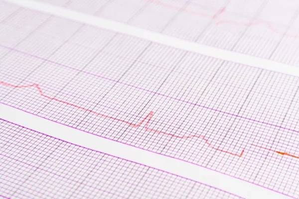 Primer plano del electrocardiograma —  Fotos de Stock