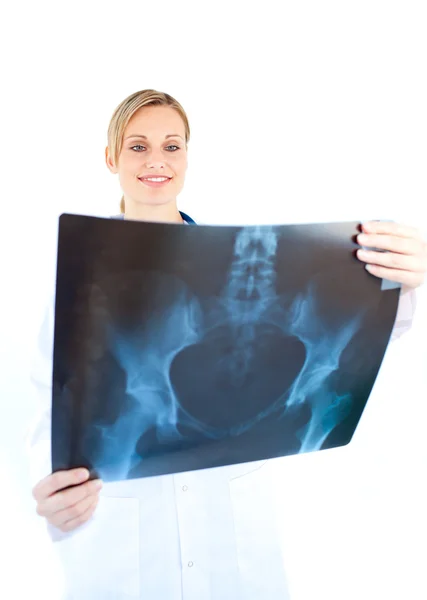 Серйозна жінка-лікар дивиться на рентгенівський знімок — стокове фото