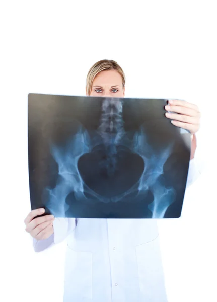 Durchsetzungsfähige Ärztin hält Röntgenbild in der Hand — Stockfoto