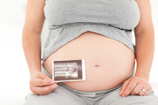 Mujer embarazada con su radiografía — Foto de Stock