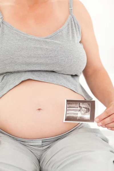 Беременная женщина с помощью рентгена — стоковое фото