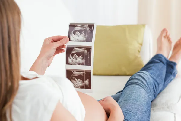 Красивая беременная женщина смотрит на сонографию — стоковое фото