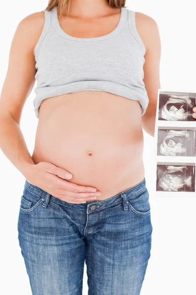 Jeune femme enceinte montrant une échographie en position debout — Photo