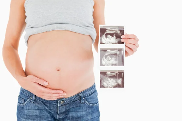 Těhotná žena ukazující ultrazvukové vyšetření stoje — Stock fotografie