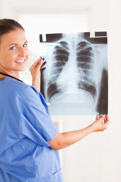Charmiga läkare ler mot kameran håller en röntgen — Stockfoto