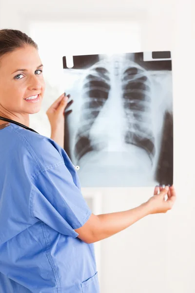 Charmanter Arzt lächelt in die Kamera mit einem Röntgenbild — Stockfoto