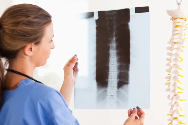 Bruneta lékaře stetoskop a o x-ray — Stock fotografie