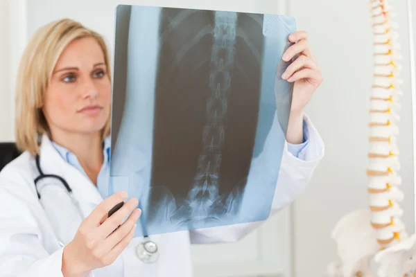 Triest uitziende arts kijken naar x-ray — Stockfoto