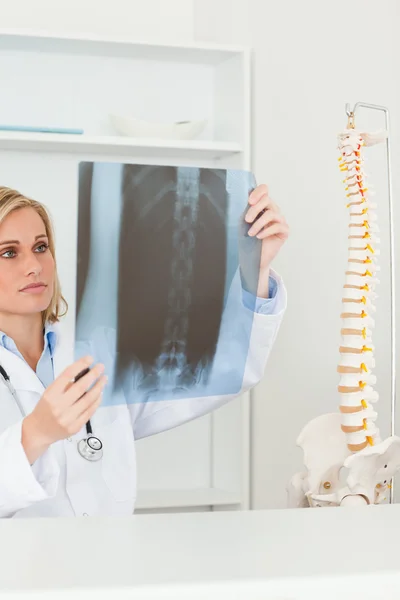 Traurig dreinblickender Arzt mit Röntgenaufnahme — Stockfoto