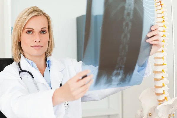 Seriöser Arzt schaut auf Röntgenbild in Kamera lizenzfreie Stockfotos