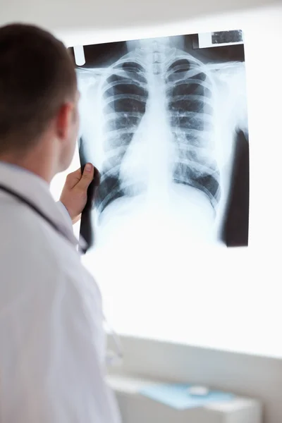 Close up of doctor using light to check x-ray — Stock Photo, Image