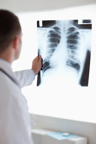 Zblízka lékaře drží x-ray proti světlu — Stock fotografie
