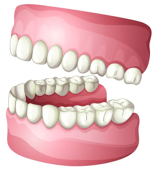 Takma diş — Stok Vektör
