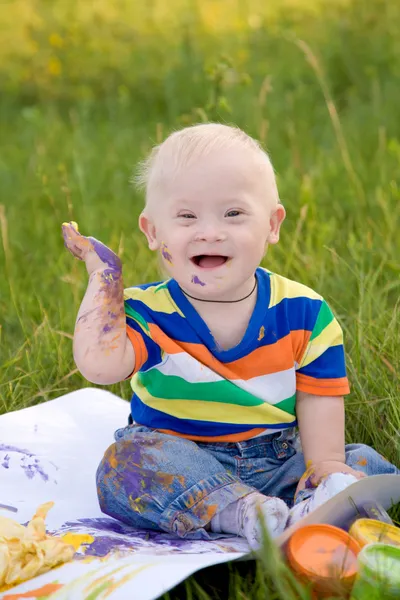 Счастливый ребенок с синдромом Дауна — стоковое фото