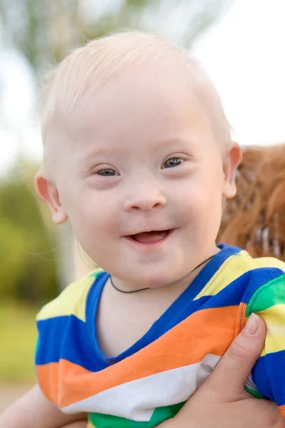 Niño con síndrome de Down — Foto de Stock