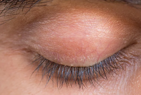 stock image Eyelid