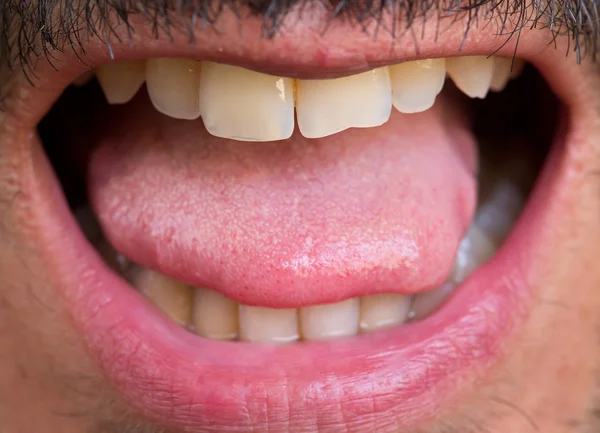 Καυκάσιος άνθρωπος ανοιχτό το στόμα — Φωτογραφία Αρχείου