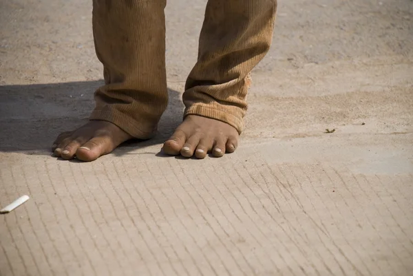 stock image Dirty Feet