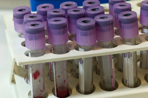Tubos de ensaio para amostras de sangue — Fotografia de Stock