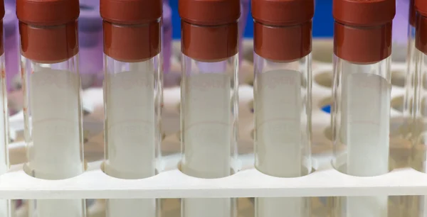 Tubos de ensayo para muestras de sangre — Foto de Stock