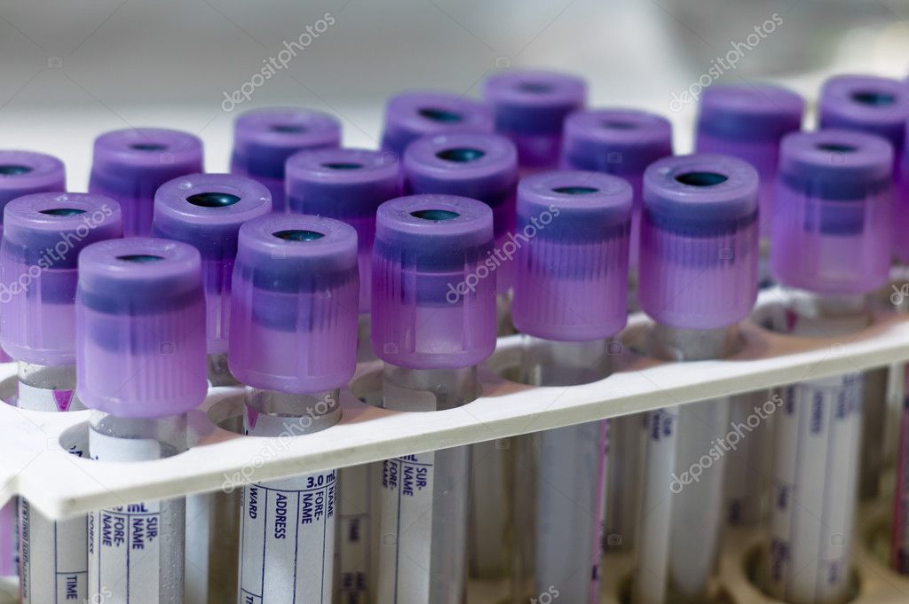 Test Tubes For Blood Samples Stock Photo Image By C Luciacv
