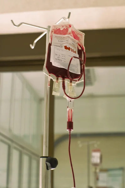 Transfusión de sangre — Foto de Stock