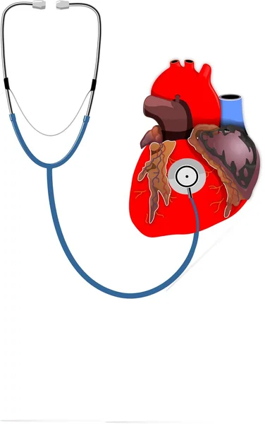 Herz und Endoskop — Stockvektor