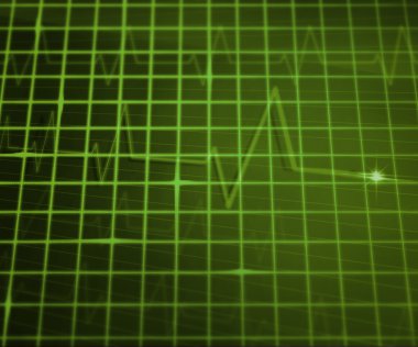 Green EKG Medical Background clipart