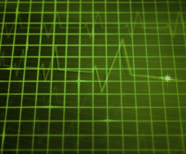 Verde EKG fundo médico — Fotografia de Stock