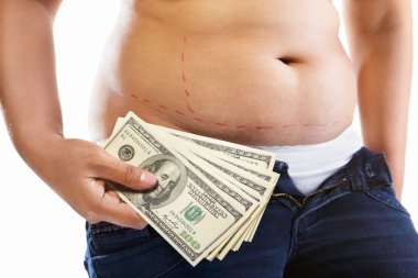 Cost of liposuction clipart