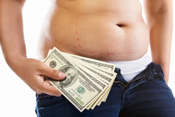 Költségét zsírleszívás — Stock Fotó