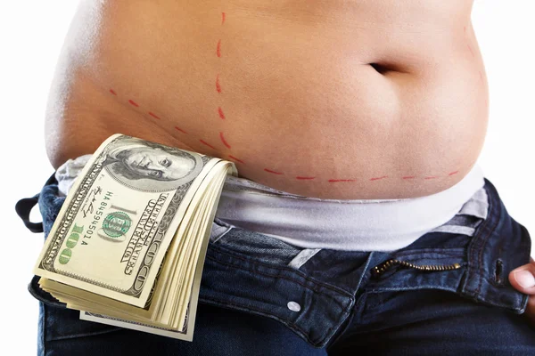Koszt liposukcji — Zdjęcie stockowe