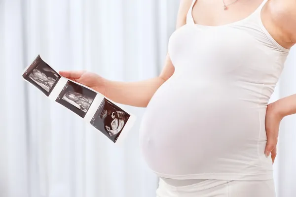 Femme enceinte tenant une échographie — Photo