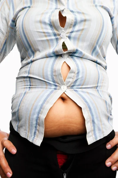 Tight shirt on overweight female body — Stock Photo, Image