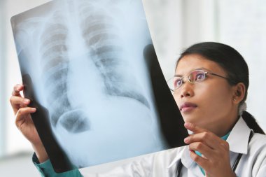 Female doctor checking xray image clipart